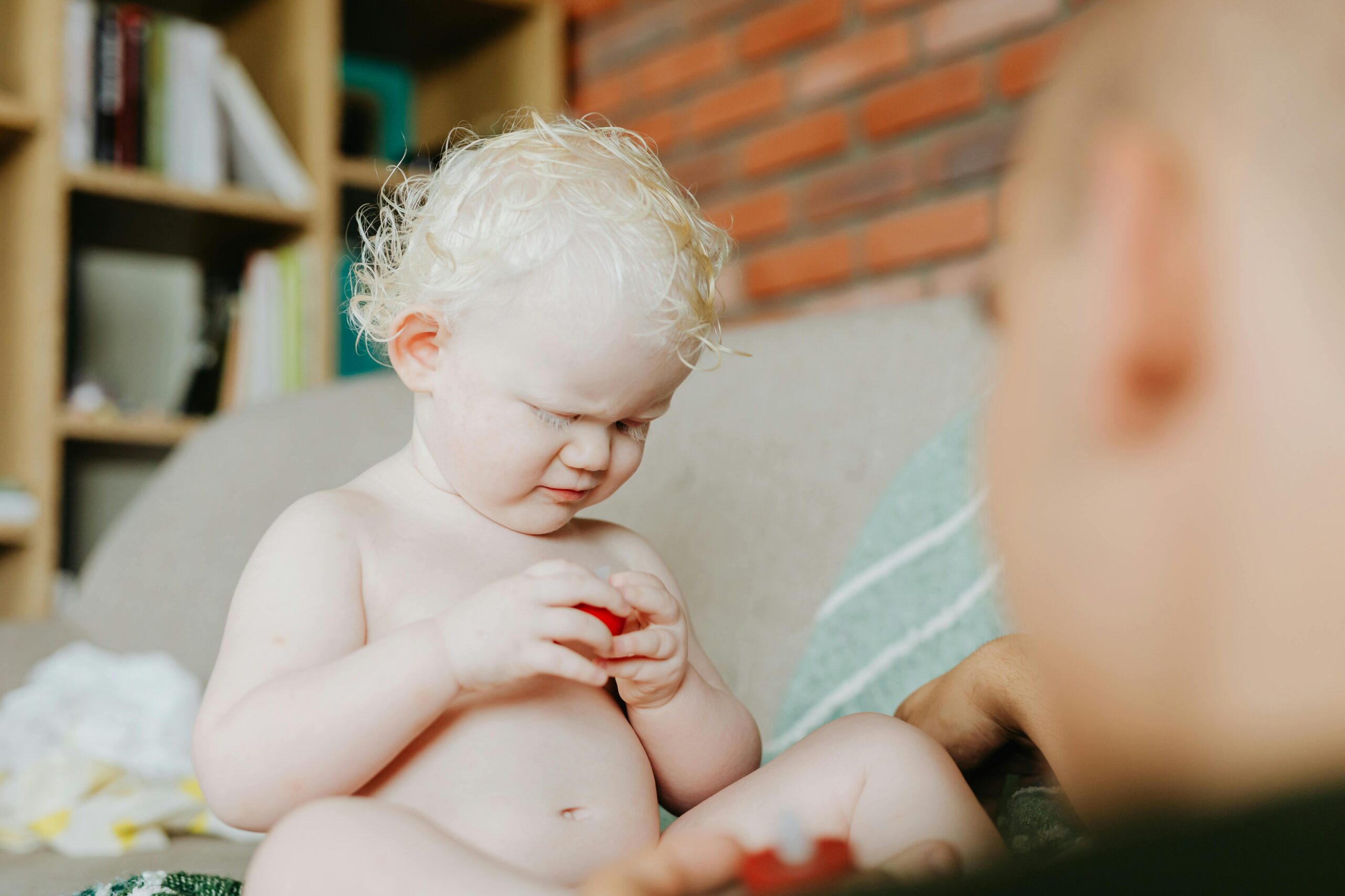 Kostenloses Stock Foto zu albino, baby, behindert